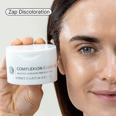 complexion