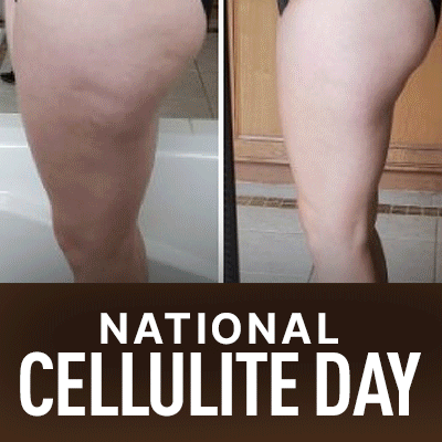 National Cellulite Day